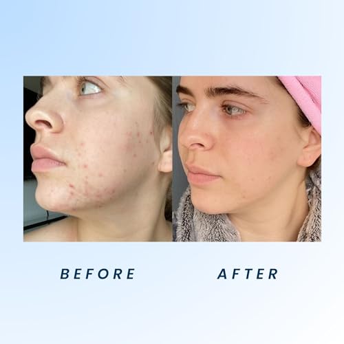 41rI0hcY4KLjpg Amazon Promo Page