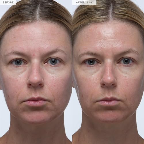 41yY9PLT8Ljpg Amazon Promo Page